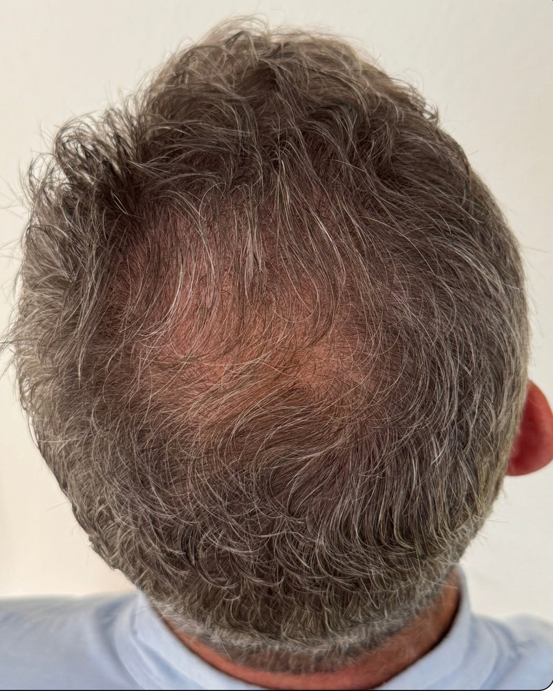 After 6 months of using R&DETAIL Scalp Activating Lotion