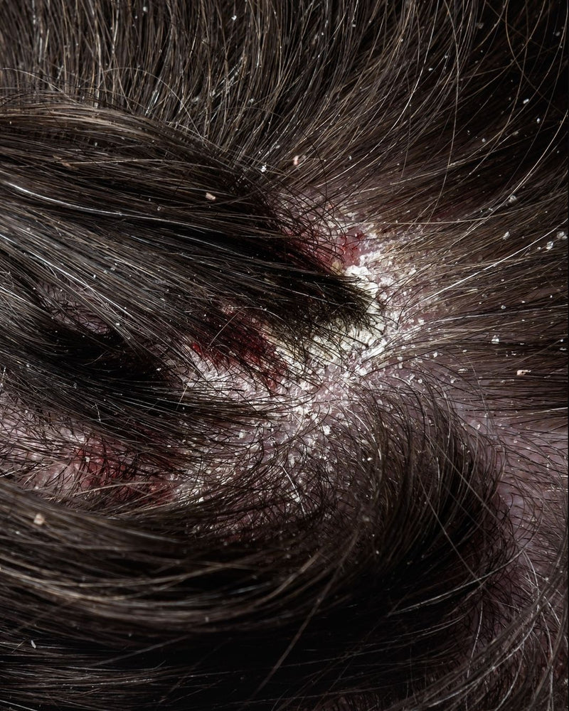 Scalp close-up, before