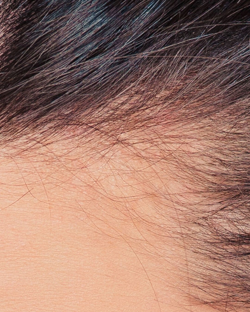 Hairline and skin close-up, after