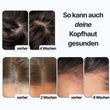 DUO: Skin Caring Shampoo 100ml + Hair Caring Treatment 200ml