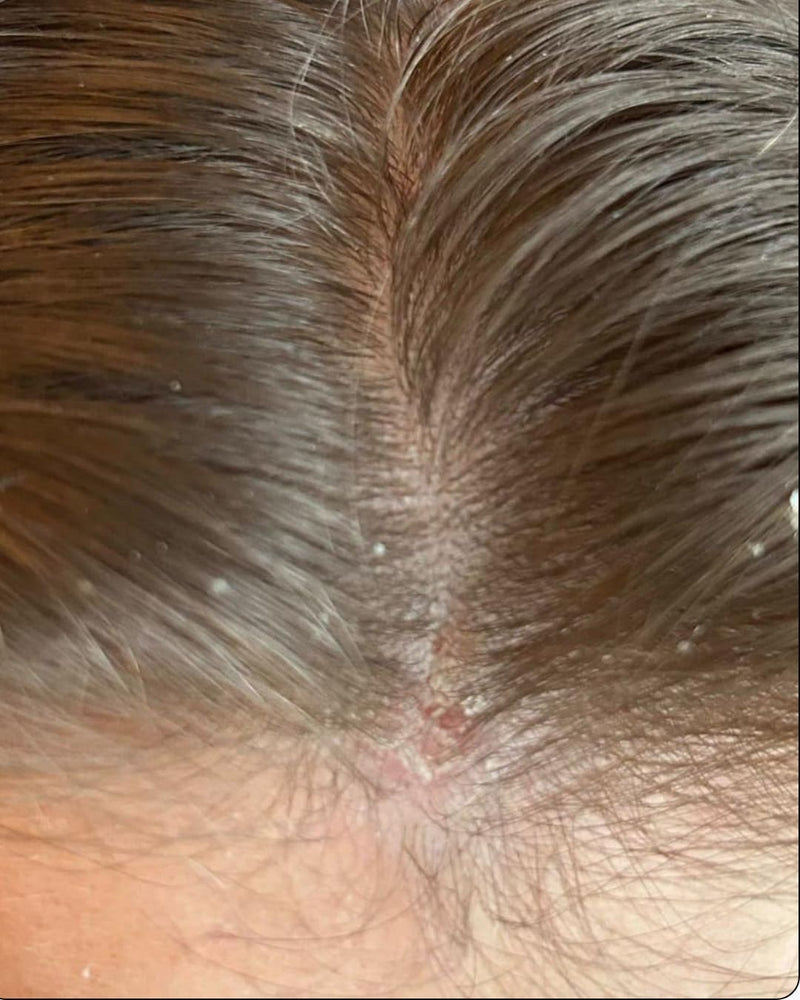 Scalp close-up, before