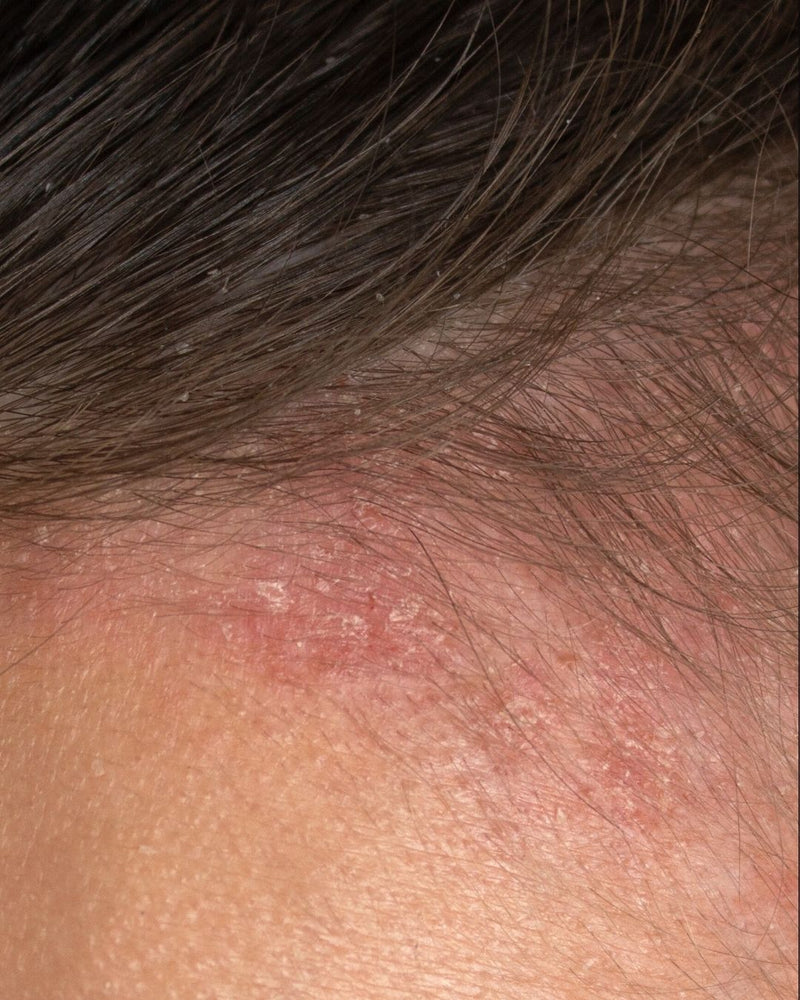 Hairline and skin close-up, before